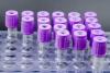 Photo for Global Blood Products Sales Market 2016 Baxter, CSL, Grifols, Octapharma, Kedrion, Hualan Bio
