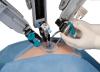 Photo for Global Surgical Robots Market 2016 Industry Growth, size, Manufacturers, and Forecast Research Report to 2021