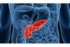 Photo for Global Pancreatic Cancer - Pipeline Market 2016-2021 Growth, Trends, Revenue, Cost, Demand