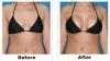 Photo for Breast Enlargement and reduction Creams Call +27638914091