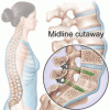 Photo for Global Spinal Fusion Market 2017-2022 Growth, Size, Trends, Manufacturing Analysis