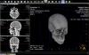 Photo for Global Medical Imaging Software Market 2016 Industry Growth, Trends, Size, Demand, Share and Analysis by 2021
