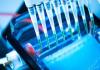 Photo for Global In Vitro Diagnostics (IVD) Quality Controls Market 2016 Industry Growth, size, Manufacturers, and Forecast Research Report to 2021