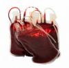 Photo for Global Blood Bank Information System Market Analysis and Forecast to 2022 by Trends, Developements, Manufacturing in Research Technologies