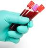 Photo for Global Blood Collection Market Analysis and Forecast to 2022 by Trends, Developements, Manufacturing in Research Technologies
