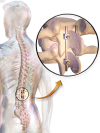 Photo for Spinal Trauma Devices Market Is Expected To Reach US$4.7 Bn By The End Of 2023