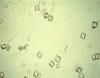 Photo for Global Calcium Oxalate Sales Market 2016 Industry Forecast, Revenue, Consumption, Import and Export by 2021