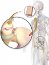 Photo for Global Bone Graft And Substitutes Market Is Anticipated To Expand At A CAGR Of 4.5% From 2015 To 2023