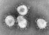 Photo for Coronavirus Infection Market: Outline , Key Trends, Key Categories, Regional Outlook & Worldwide  Industry Analysis By 2024