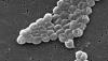 Photo for Acinetobacter Infections Treatment Market : Popular Trends & Technological Advancements To Watch Out For Near Future; Global Industry Analysis 2024