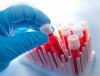 Photo for Blood Collection Tubes Market Is Predicted To Reach US$632.1 mn By The End Of 2023
