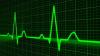 Photo for Peripheral Intravenous Catheter Market Will hit at a CAGR of 6.1% in from 2016 to 2021