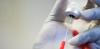 Photo for Erythropoietin Drugs Market is Expected to Reach $11.9 Billion, Globally, by 2020