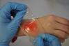 Photo for Global Water Gel Dressing Market Research Report 2017