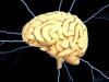 Photo for Interventional Neurology Market to surpass US$ 2.7 Billion by 2024 : Coherent Market Insights