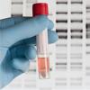 Photo for Global Recombinant Protein Market Research Report 2016