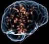 Photo for Deep Brain Stimulation Market to Surpass US$ 1.4 Billion by - 2024