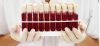 Photo for Artificial Blood Market Segments and Key Trends 2016-2024