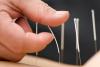 Photo for Services on Location Acupuncture yonge & Davisville