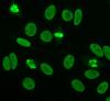 Photo for Bispecific Antibodies Market Global Industry Insights 2024