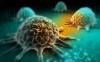Photo for Bone Cancer Treatment Market - Industry Insights, Trends, and Opportunity Analysis, 2016-2024