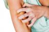 Photo for Pruritus Therapeutics Market to Record an Impressive Growth Rate During the Forecast 2020