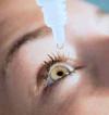 Photo for China Sjogren’s Syndrome Market Research Report 2017