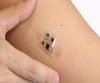 Photo for Biosensors Market to witness increasing growth, Globally by 2024