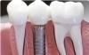 Photo for Ricard Family Dentistry - Port St. Lucie