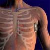 Photo for Global Defibrillators Market Forecasts up to 2024, Research Reports- Coherent Market Insights