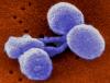 Photo for Gonorrhea Diagnostic Market Forecasts up to 2024, Research Reports- Coherent Market Insights