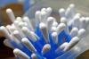 Photo for Diabetic Alcohol Swabs Market Forecasts up to 2024, Research Report - Coherent Market Insights