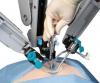Photo for United States Gynecology Robotic Surgery Market Forecast 2017