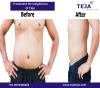 Photo for Get a Perfect Body Shape in Single Sitting at Teja's