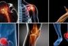 Photo for Orthopedic Software Market – Current Trends, Opportunities and Challenges