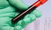 Photo for Liquid Biopsy Market to increase steadily by 2016-2024