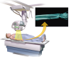 Photo for Digital Radiography Market to Surpass US$ 12.5 Billion by 2024 : Coherent Market Insights