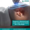 Photo for Pain Less Ultrasound Scanning Services @ Aruna Diagnostics