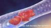 Photo for Sickle Cell Anemia Therapeutics Market – Global Industry Insights, Trends and Opportunity Analysis, 2016–2024