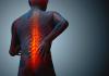 Photo for Beverly Hills Spine Surgeons Help Find Out the Best Treatment to Relieve Your Chronic Pain