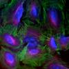 Photo for High Content Screening Market Growth, Trends, Analysis & Forecast 2022