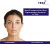 Photo for Best Treatment for Skin Pigmentation Removal @ Teja