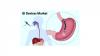 Photo for Gastrointestinal Devices Market – Global Industry Insights, Trends and Opportunity Analysis, 2016–2024