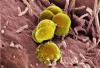 Photo for Gonorrhea Diagnostic Market — Global Industry Insights Forecast upto 2024