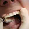 Photo for Safe Mercury Removal | Dr. Philip Memoli | Newark