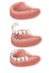 Photo for Wilshire Smile Studio - Los Angeles Oral Surgeon