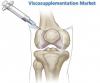Photo for Viscosupplementation Market – Global Industry Insights, Trends, Outlook, and Opportunity Analysis, 2016–2024