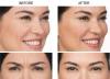 Photo for http://www.realsupplementfacts.com/skin-novela/