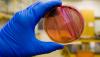 Photo for E. Coli Testing Market Reflecting a CAGR of 6.5% by 2021 End