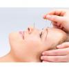 Photo for Classical Five Element Acupuncture